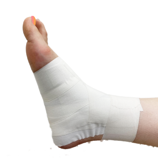 手首の捻挫治療イメージ写真